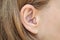 A woman with a hearing aid close-up