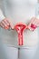 Woman holding Uterus and Ovaries model. Ovarian and Cervical cancer, Cervix disorder, Endometriosis, Hysterectomy, Uterine