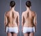 Woman with large scar on the back, before after concept