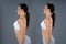 Woman With Lordosis And Normal Curvature
