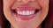 Woman, mouth and teeth whitening with dental closeup, smile and health with happiness and face. Orthodontics, beauty and