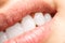 Woman Natural Lips And White Teeth Macro