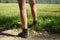 Woman with painful varicose veins on legs resting on a walk through nature