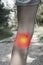 Woman with painful varicose veins and red dot effect