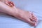 Woman palpates hand leg ankle hygroma in joint, foot closeup view.