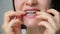 Woman puts in her mouth dental mouthguard, splint for the treatment of dysfunction of the temporomandibular joints