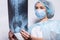 Woman raising her hand up and holding an x-ray picture doctor medicine