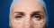 Woman is ready for face plastic surgery. facelift procedure