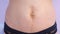 Woman`s abdomen after carboxytherapy injections in clinic, closeup view.