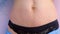 Woman`s abdomen after childbirth and pregnancy, skin with heavy stretches.