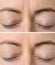 Woman`s face skin before and after aesthetic beauty cosmetic procedures with removed skin wrinkles