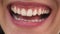 Woman`s mouth with white teeth laughing