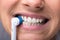 Woman`s Teeth With Electrical Toothbrush