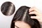 The woman scratches her head with her hand, showing a parting of dark hair with dandruff.Close up.The view from the top. White