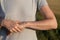 woman showing abrasions and scratches on her arm