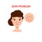 Woman with skin problem. Vector