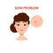 Woman with skin problem. Vector