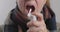 A woman with a sore throat sprays medicine aerosol spray down her throat