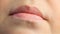 Woman with sores from herpes on her lips, herpes. lip treatment, slow-motion shooting, copy space