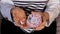 Woman sorting pills Organizer weekly shots Closeup of medical pill box with doses of tablets for daily take medicine