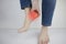 Woman suffering from heel pain. Inflammation or sprain of the tendon in the foot, heel spur, bursitis. The concept of diseases and