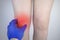 A woman suffers from knee pain. Examination by an orthopedist and traumatologist. Redness and swelling of the legs, torn meniscus