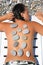 Woman sunbathes on beach with stones on back