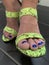 Woman wearing neon snakeskin shoes with blue nail polish