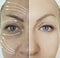 Woman wrinkles tightening revitalization concept face before and after treatment arrow