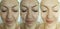 Woman wrinkles tightening revitalization result concept face before and after treatment arrow