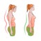 Woman with wrong and right back posture