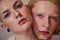 Womanlike albino man with long blonde hair holding head at the shoulder of bald masculine female