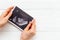 Womans hands holding ultrasound scan of unborn baby. Pregnancy background