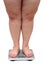 Women legs with overweight