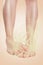 Women`s club-footed feet, exuding a stinking smell. Beige background. Close up. Concept of foot and nail fungus, skin diseases