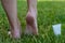 Women`s heels feet with dry skin and scaly with cream on grass