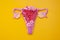 The women`s reproductive system. The concept of endometriosis of the uterus