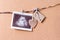 a wooden heart and a snapshot of an ultrasound scan pinned to a rope on a cork board with a small wooden clothespin