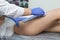 Worker Beautician Depilation With Hot Wax Woman`s Leg In Beauty Spa. Body hair removal. Hair removal process on female leg with