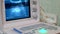 Working ultrasound medical equipment