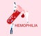 World Hemophilia Day concept. Coagulation factor and blood clotting problem.Laboratory tube with cancer blood full of cells.