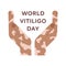 World vitiligo day. Square poster or card template. Two symmetric human hands and text. Color flat illustration of celebration