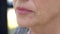 Wrinkled face of elderly woman, cosmetological injections, plastic surgery