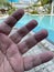 Wrinkled fingers because of soak in the water for a long time