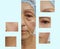 Wrinkles elderly woman face effect lifting rejuvenation correction before and after cosmetic procedures anti-aging