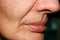 Wrinkles on the lips and chin. Nasolabial folds. Fluff mustache.