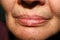 Wrinkles on the lips and chin. Nasolabial folds. Fluff mustache.