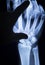 Wrist hand injury xray scan