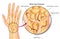 Wrist joint fractures