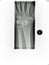 Wrist x-ray